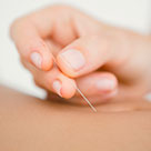laser-acupuncture laser-acupuncture
